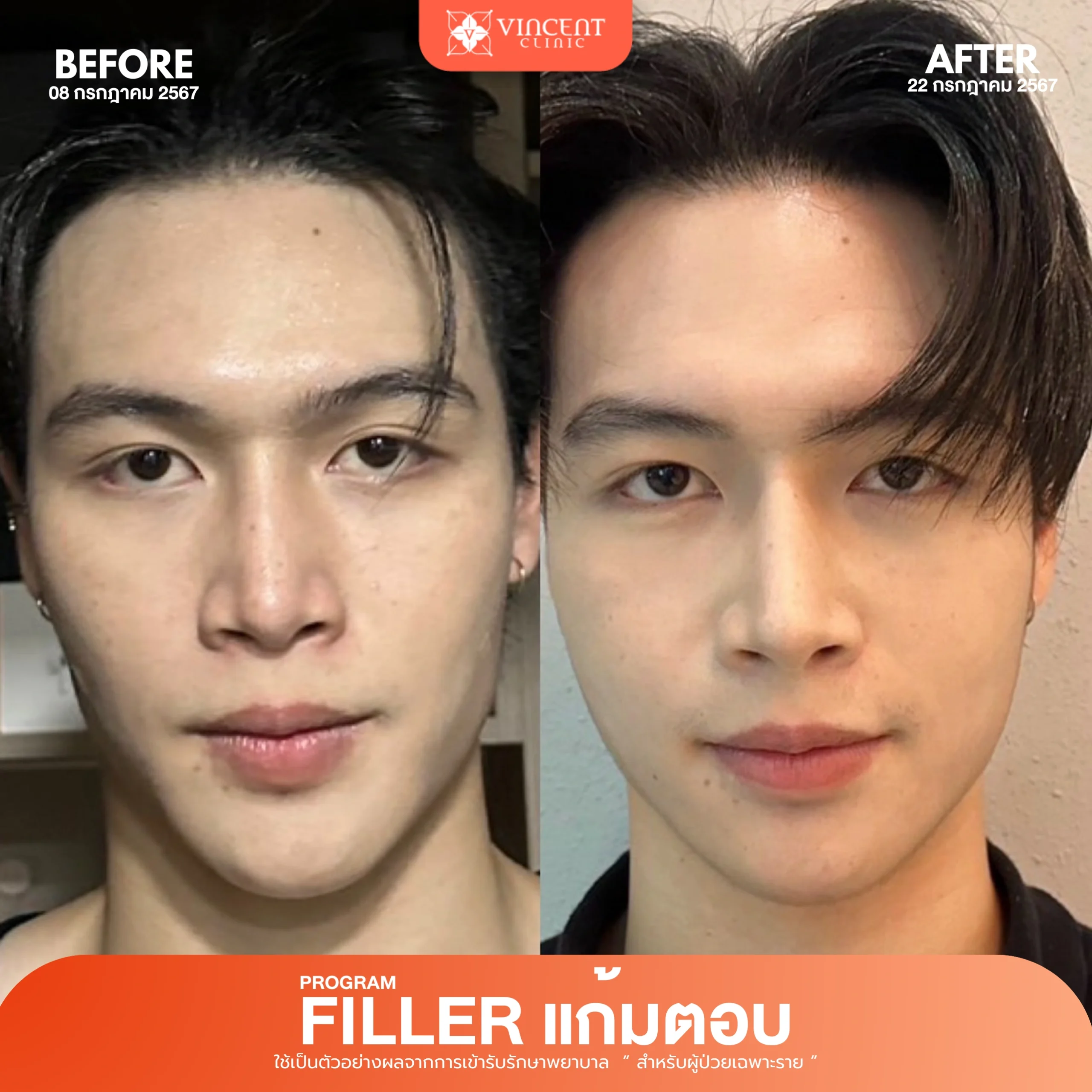 รูปรีวิว