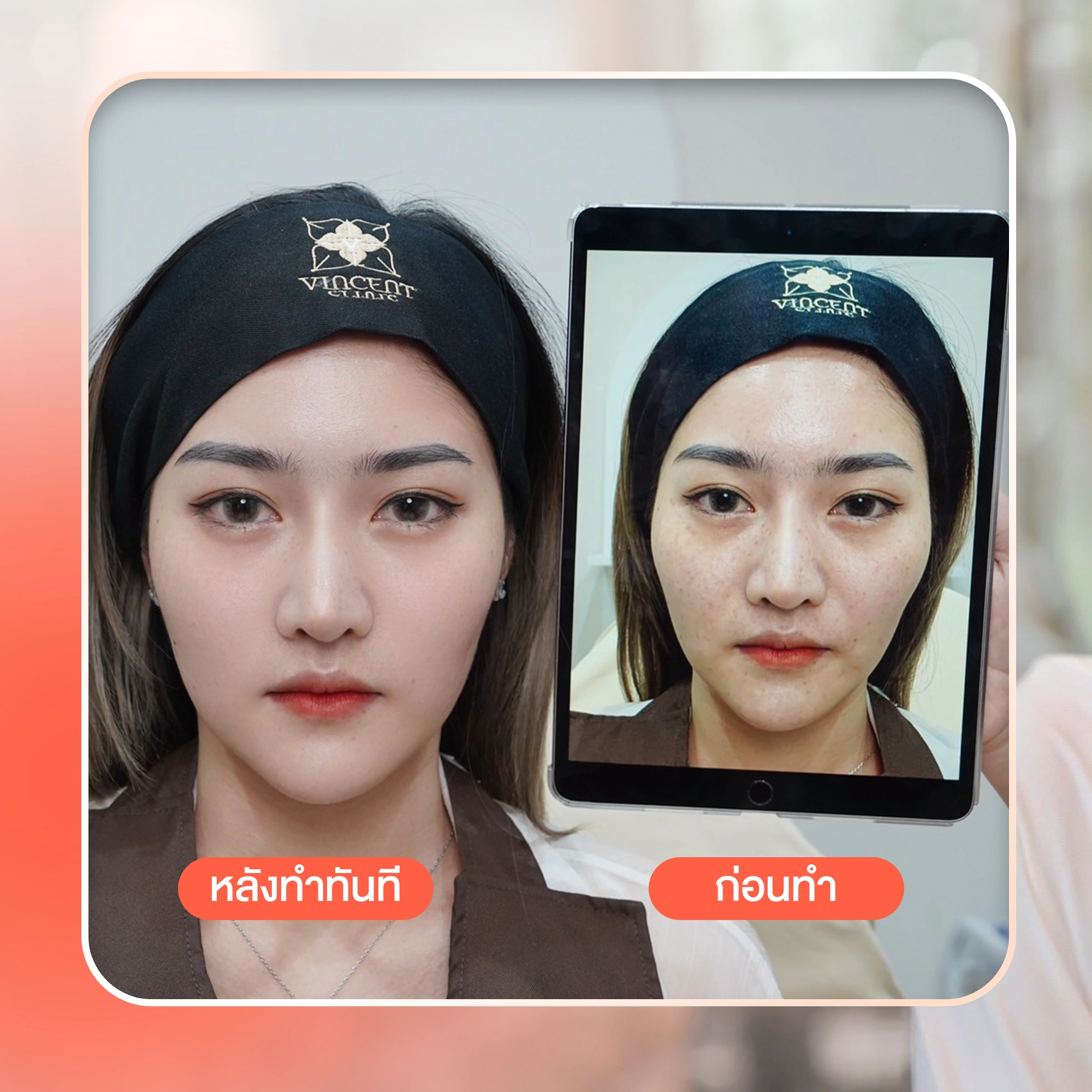 รูปรีวิว