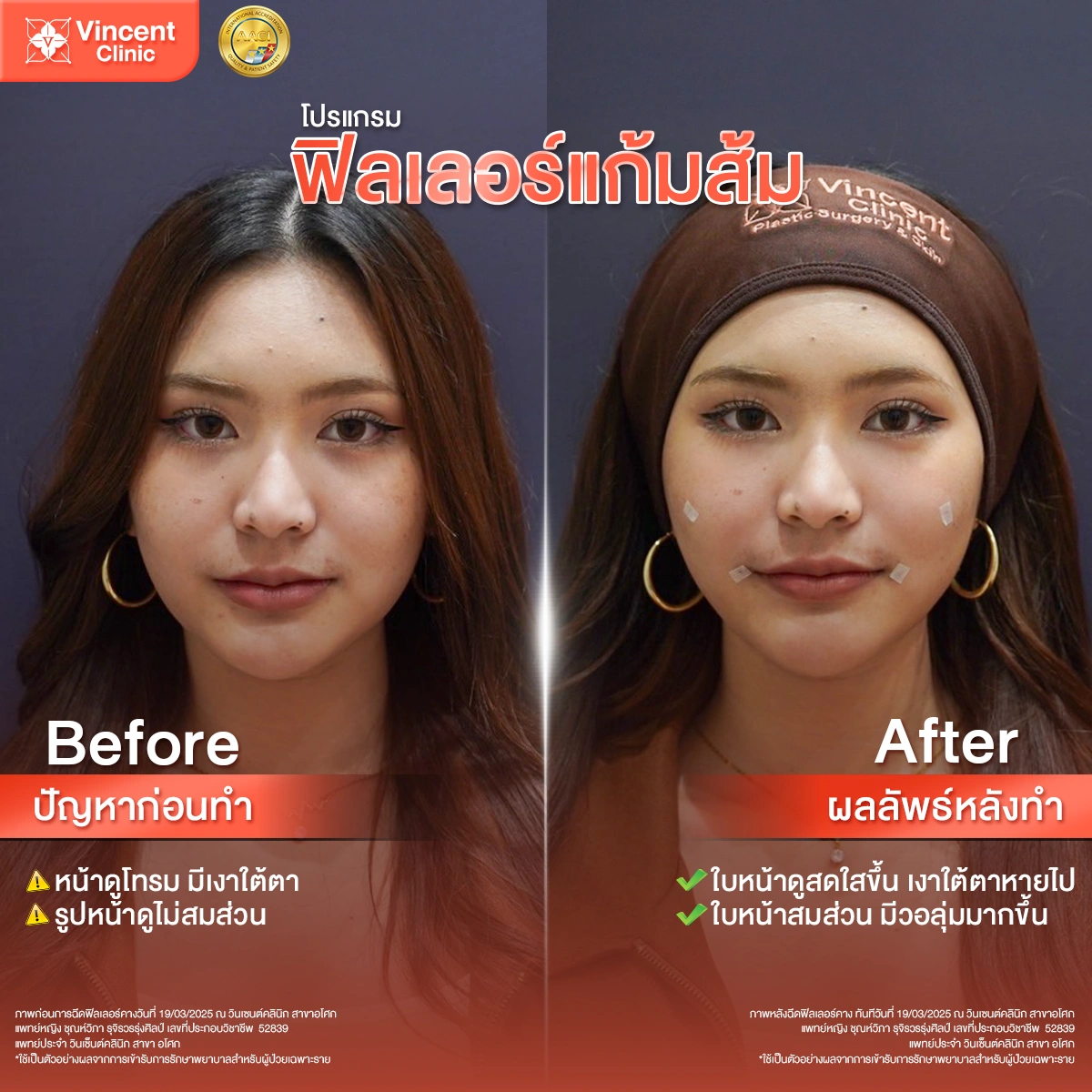 รูปรีวิว