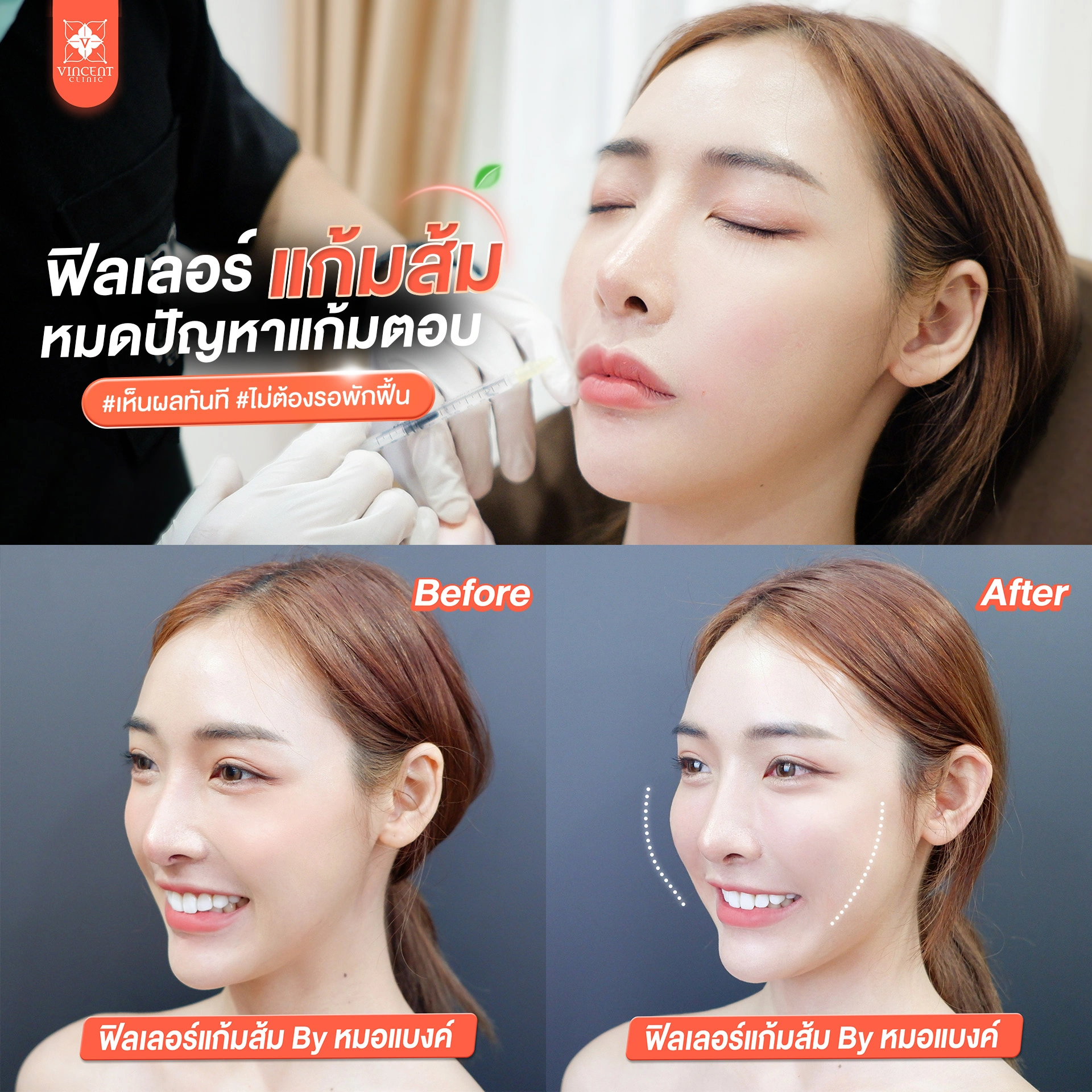 รูปรีวิว
