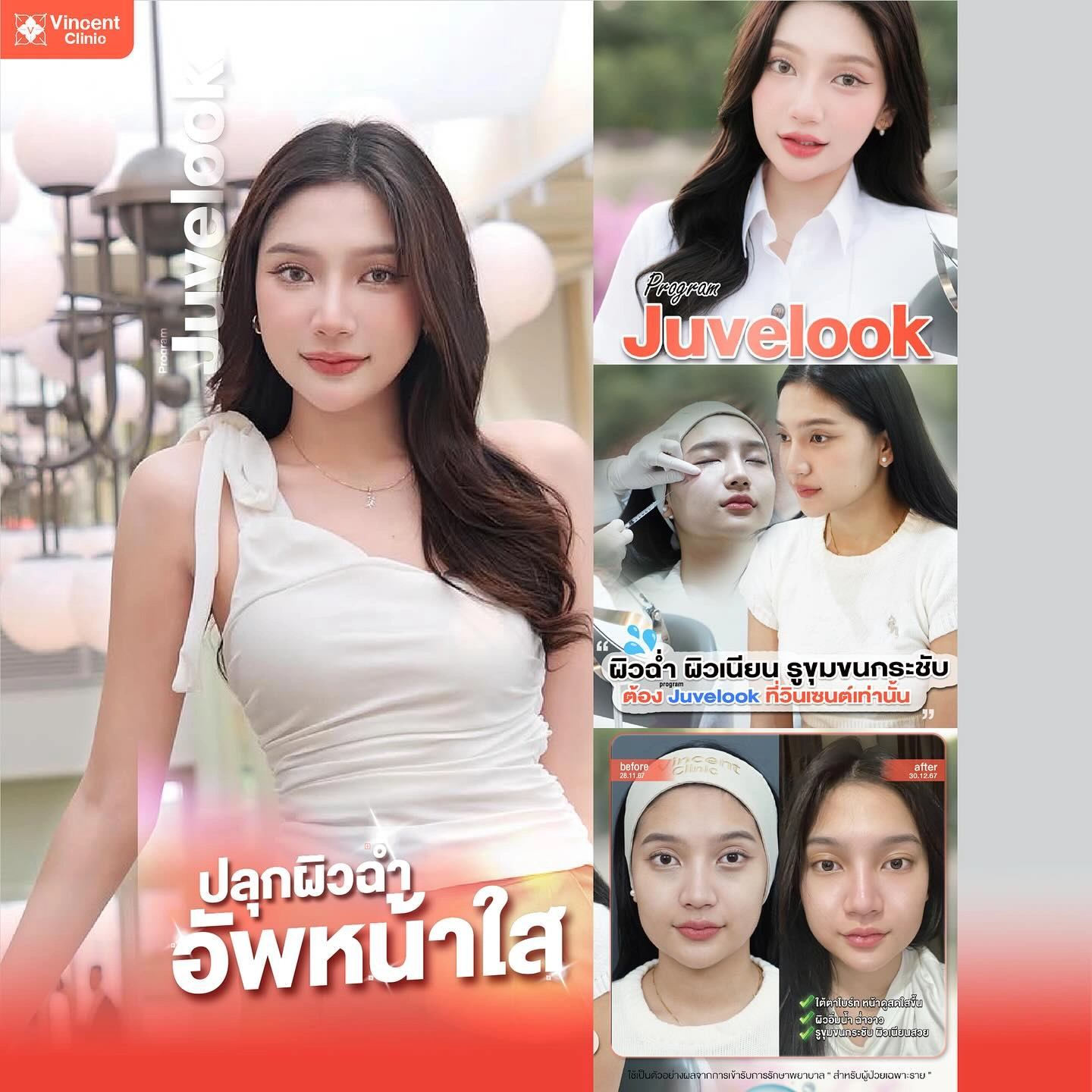 รูปรีวิว