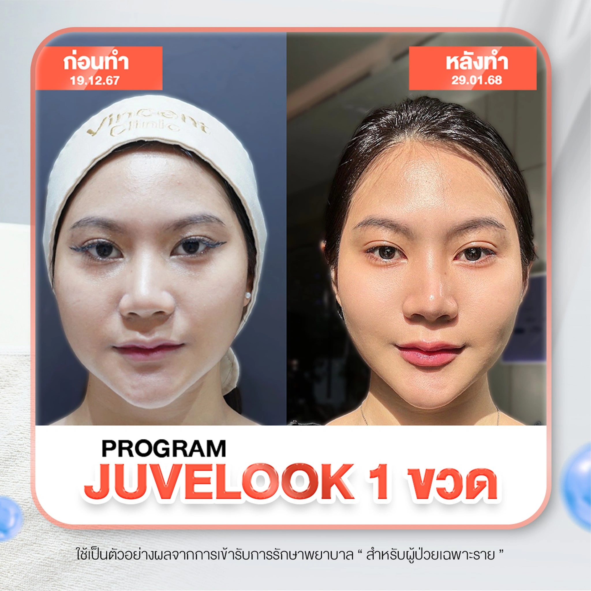รูปรีวิว