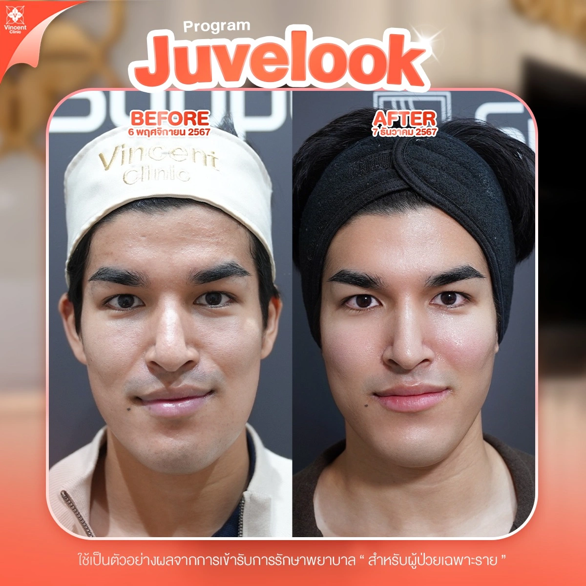 รูปรีวิว