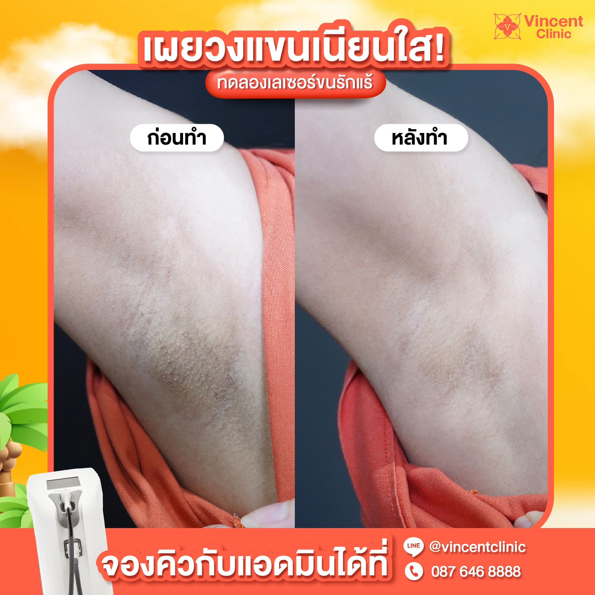 รูปรีวิว