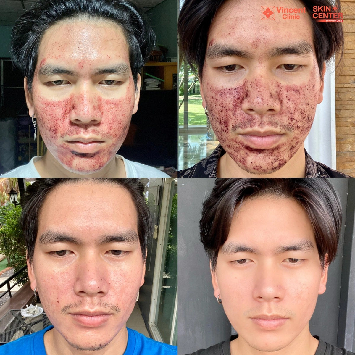 รูปรีวิว