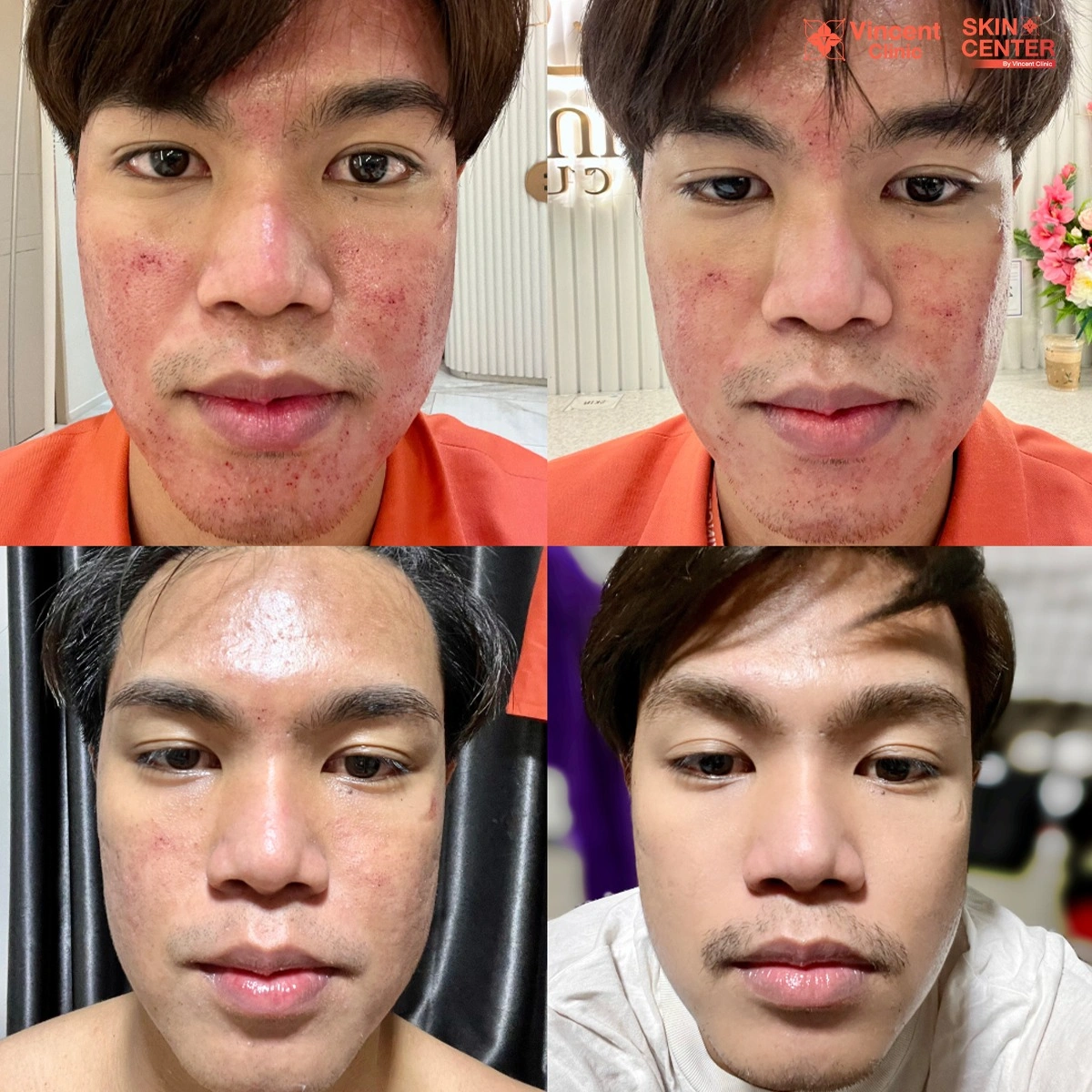 รูปรีวิว