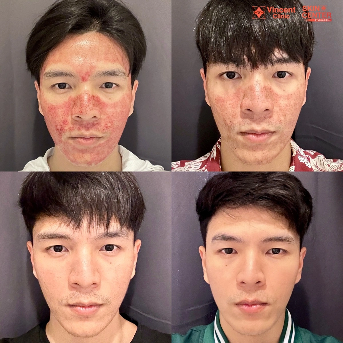 รูปรีวิว