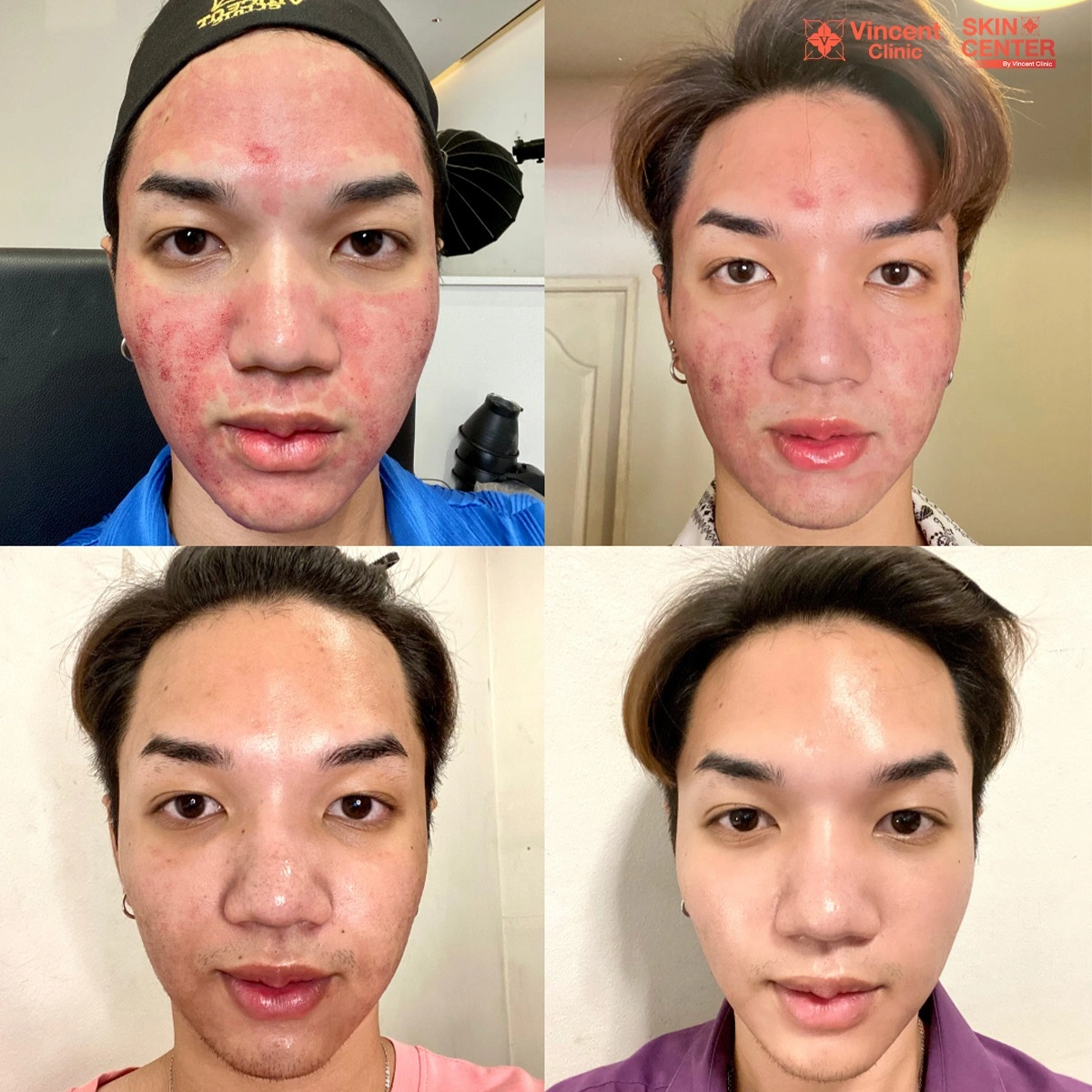 รูปรีวิว