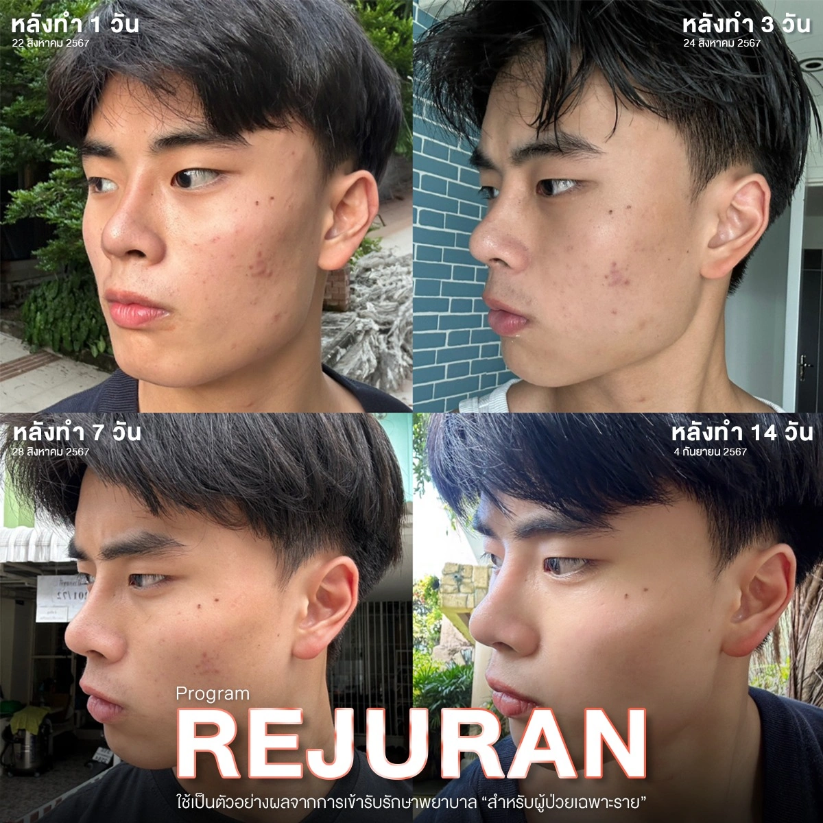 รูปรีวิว