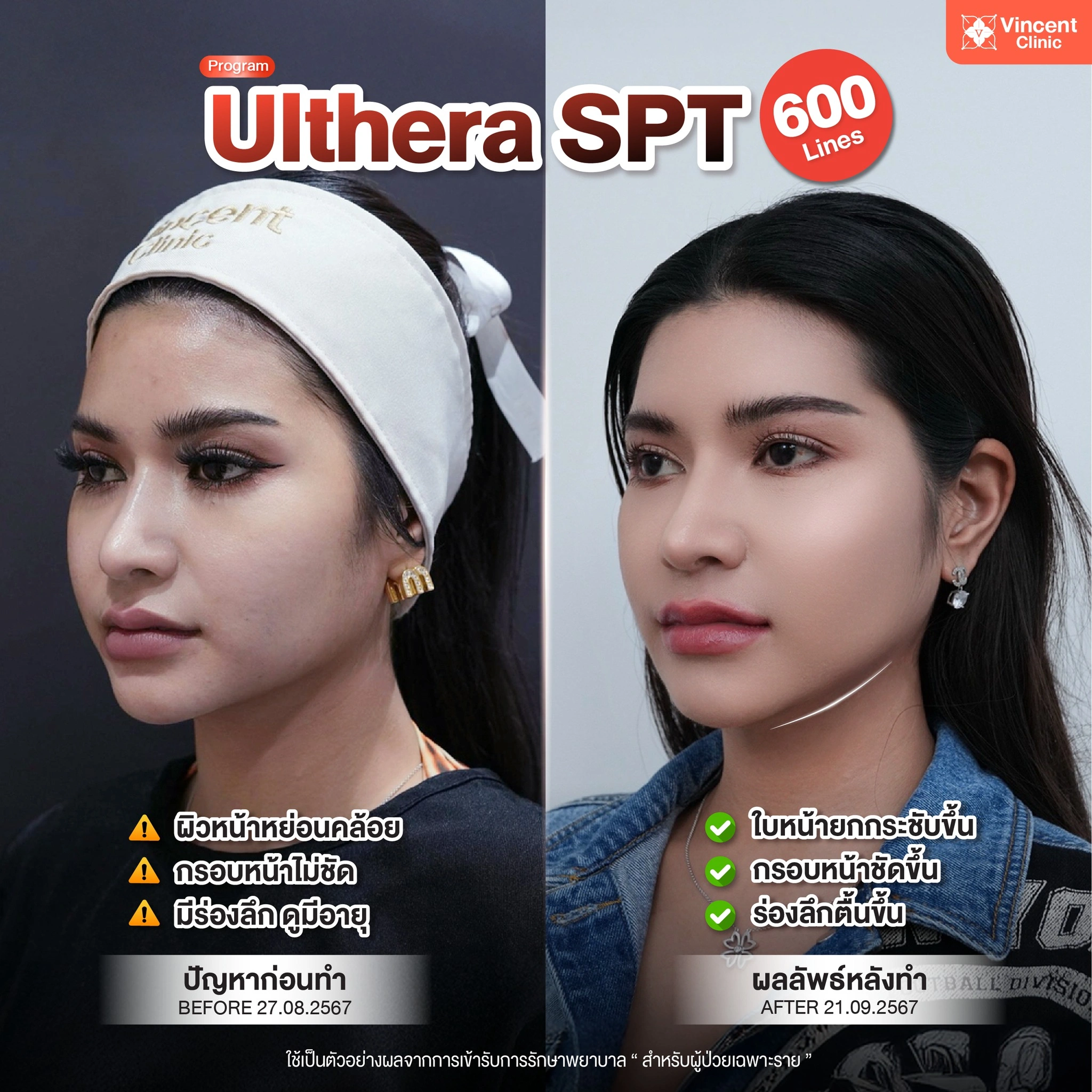 รูปรีวิว