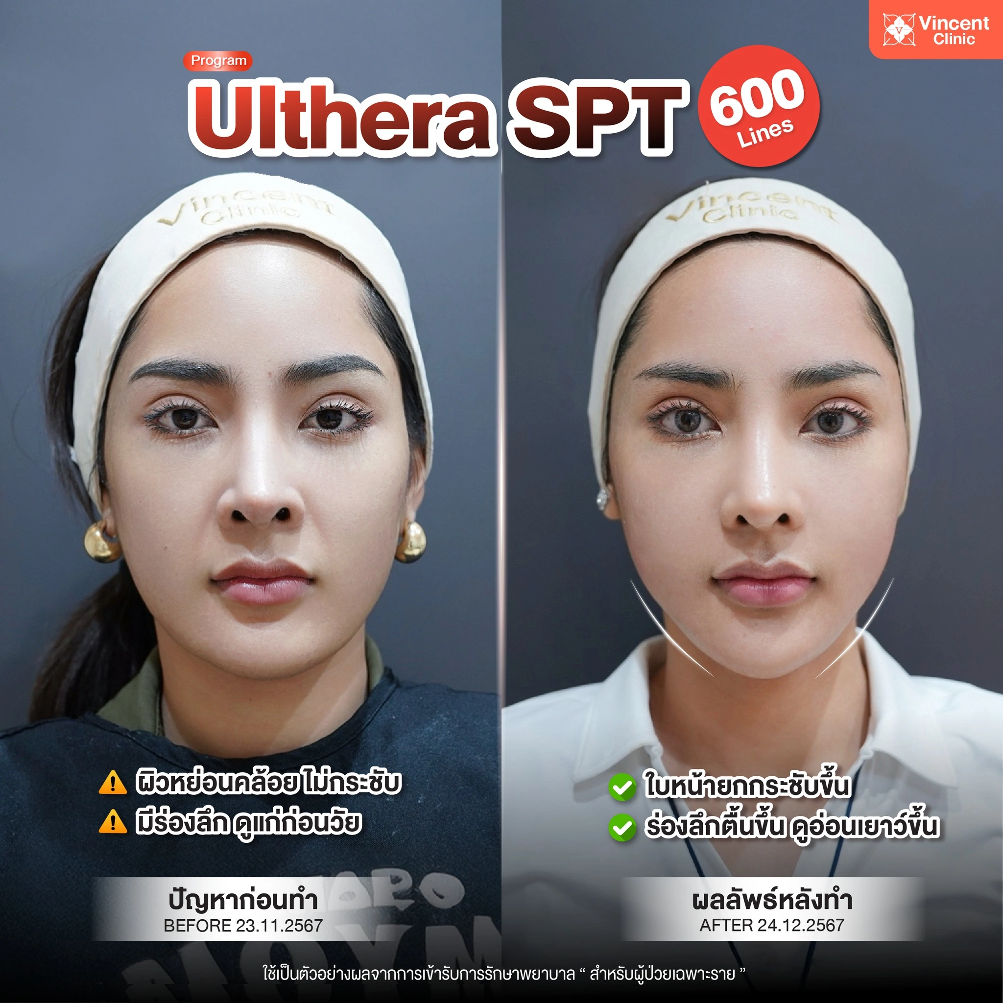 รูปรีวิว