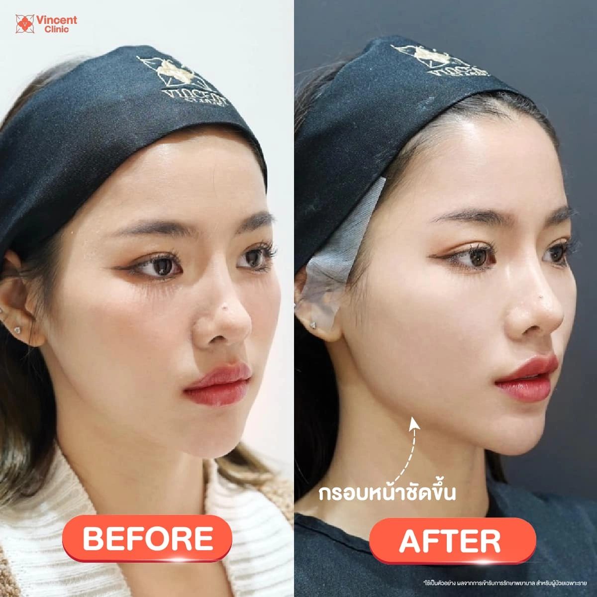 รูปรีวิว