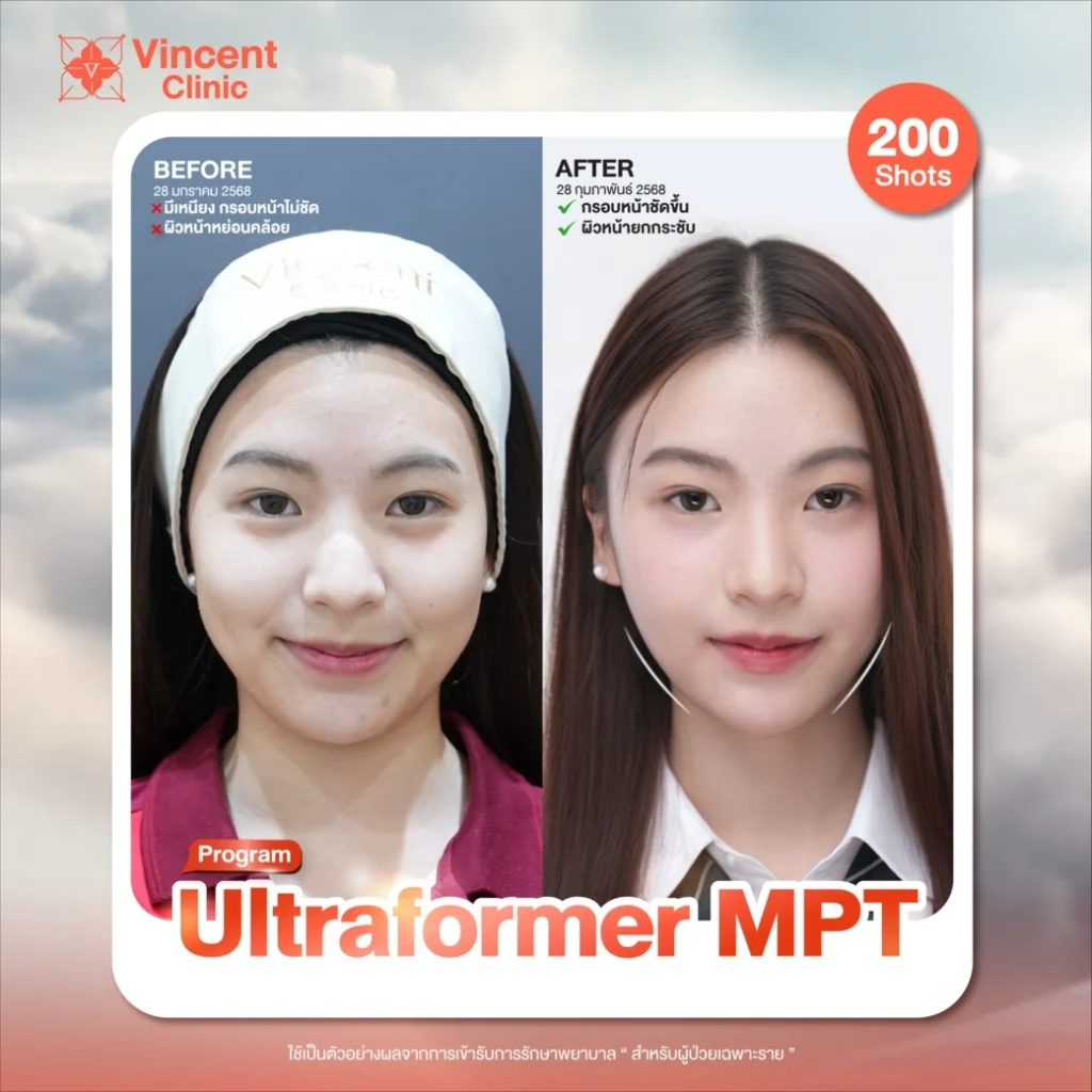 review-ultraformer2