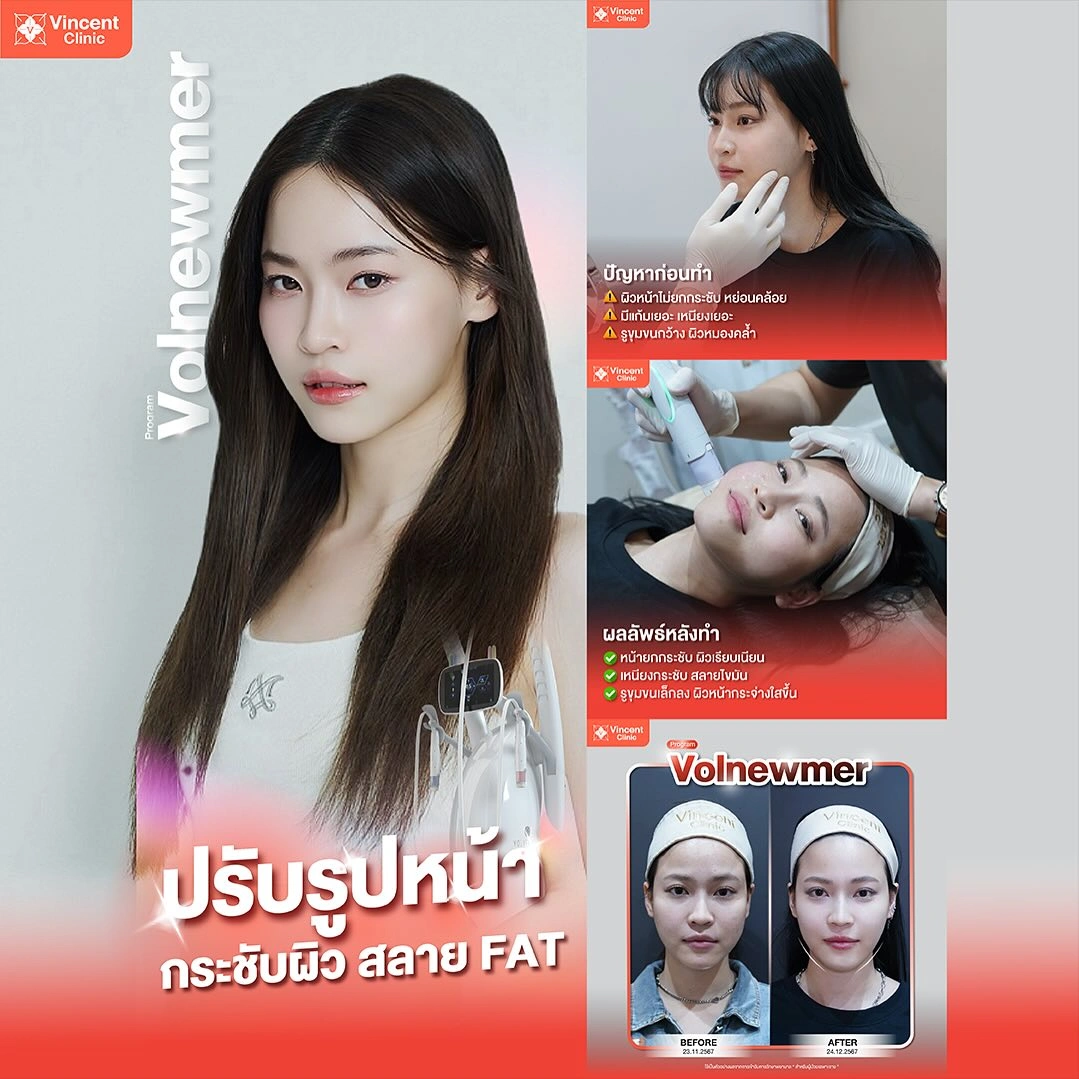 รูปรีวิว
