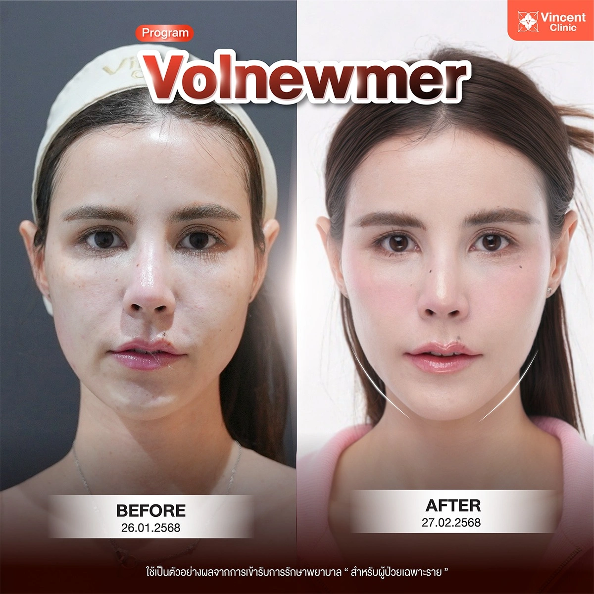 รูปรีวิว