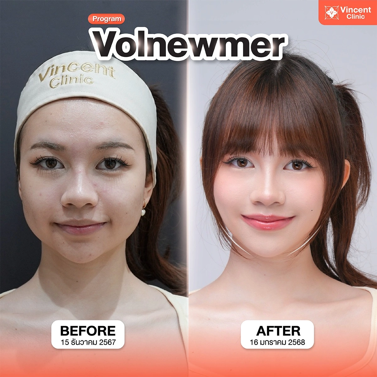 รูปรีวิว