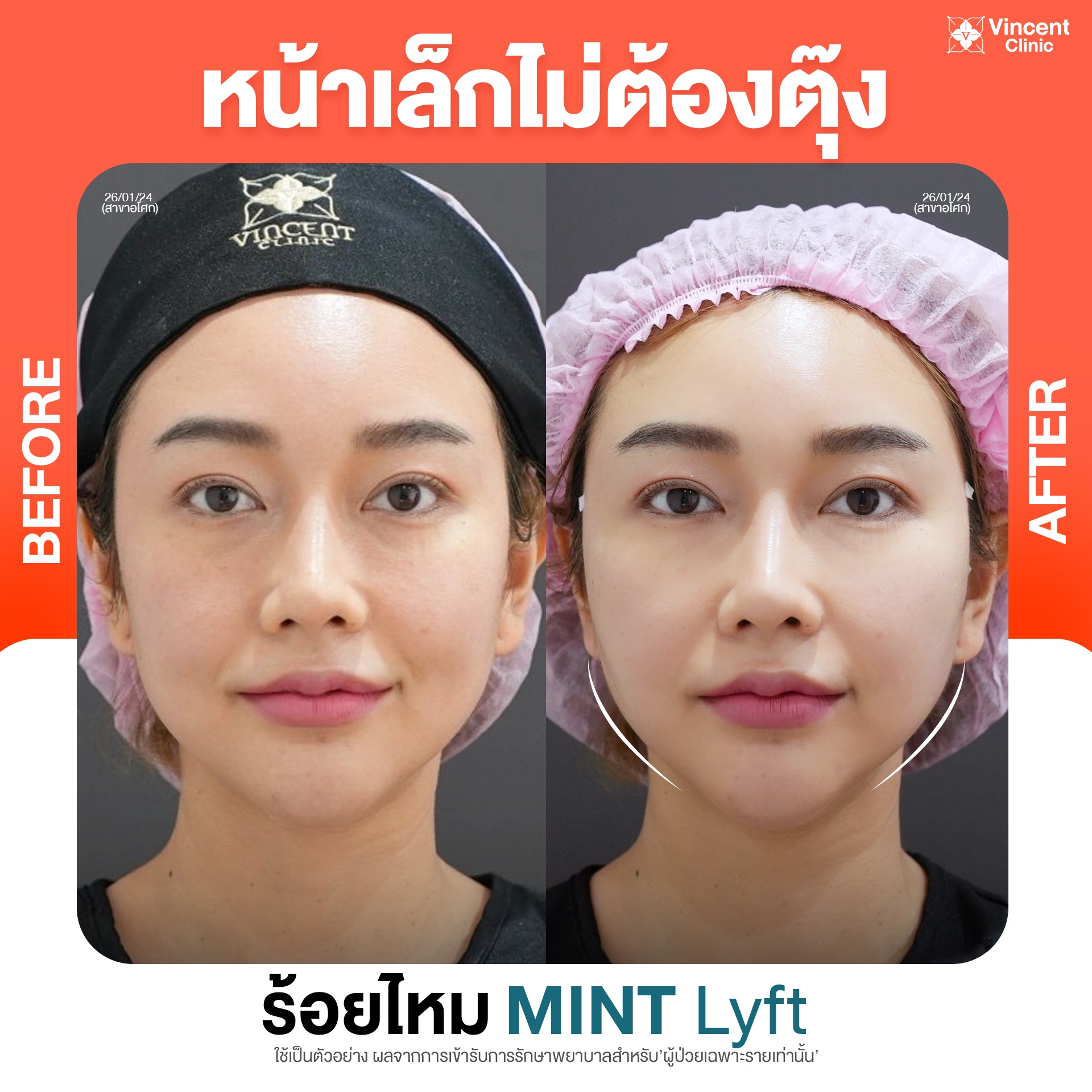 รูปรีวิว