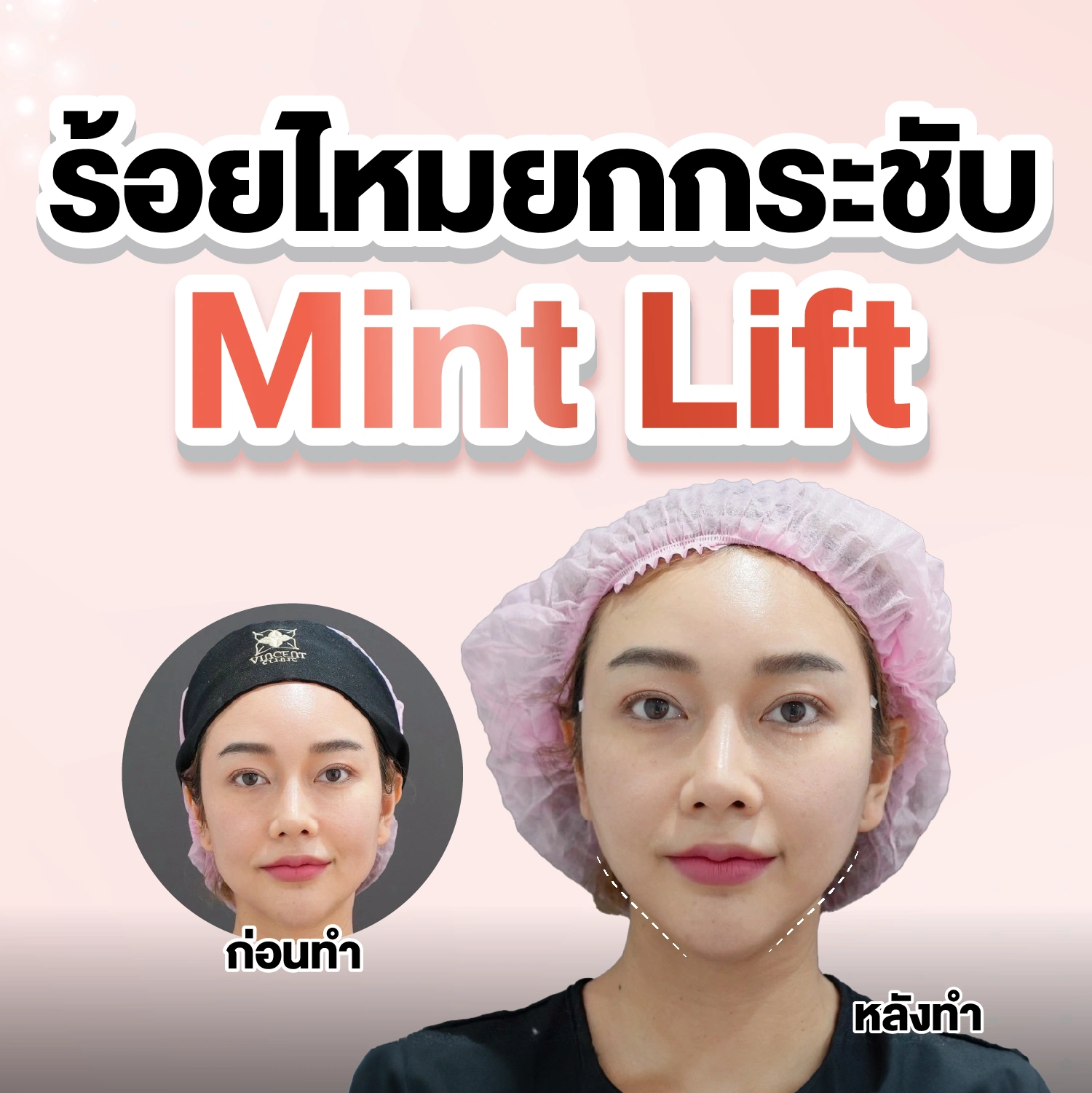 รูปรีวิว
