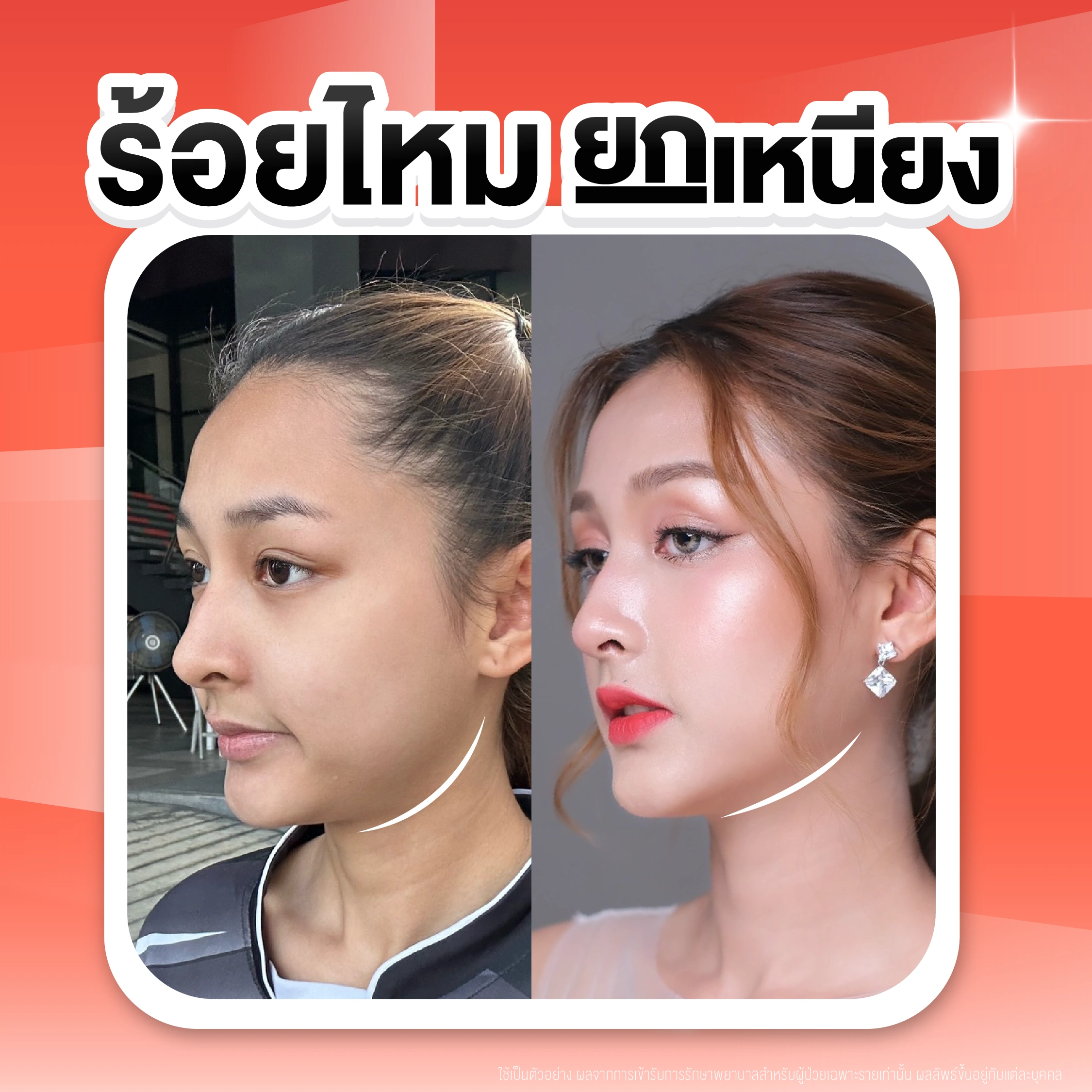 รูปรีวิว