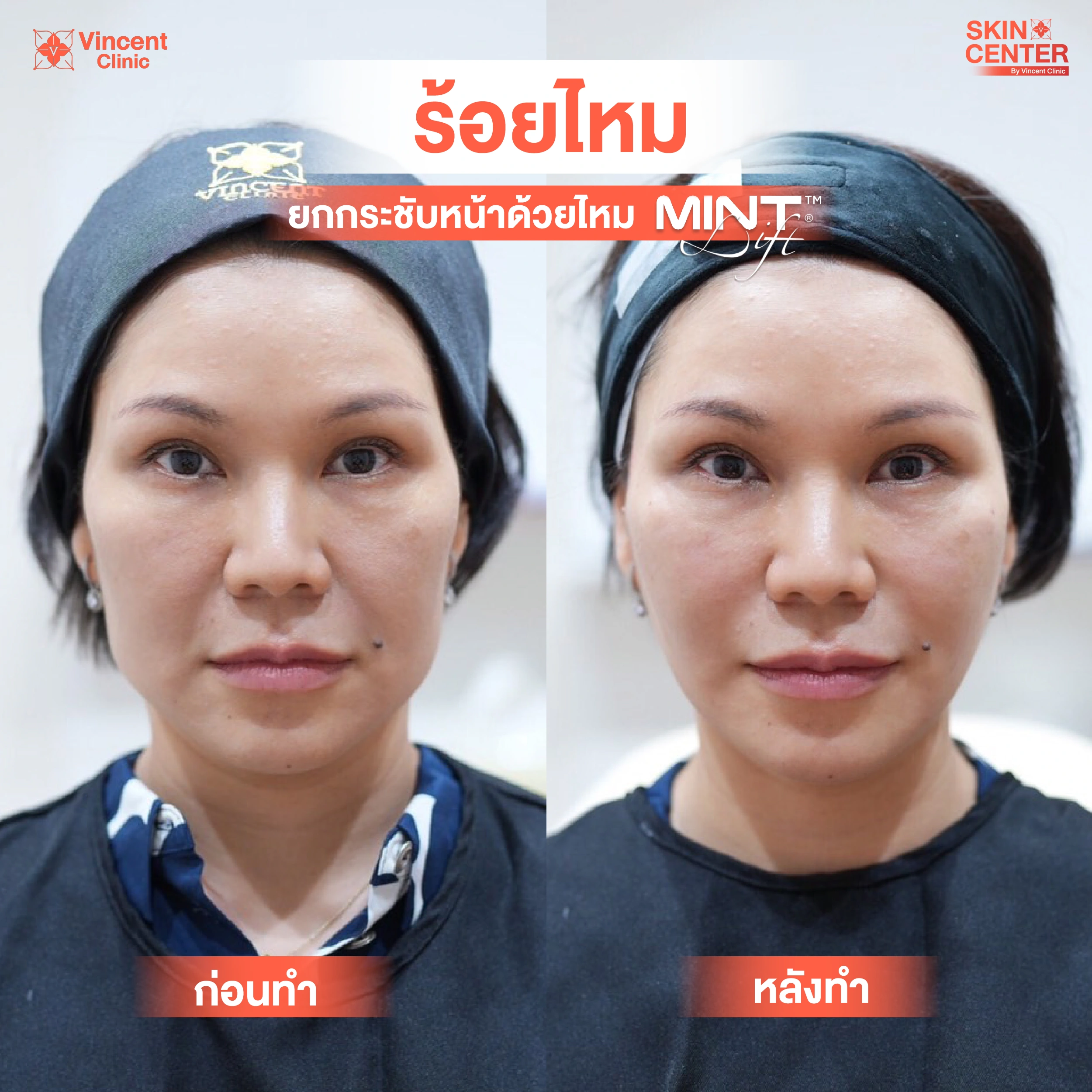รูปรีวิว