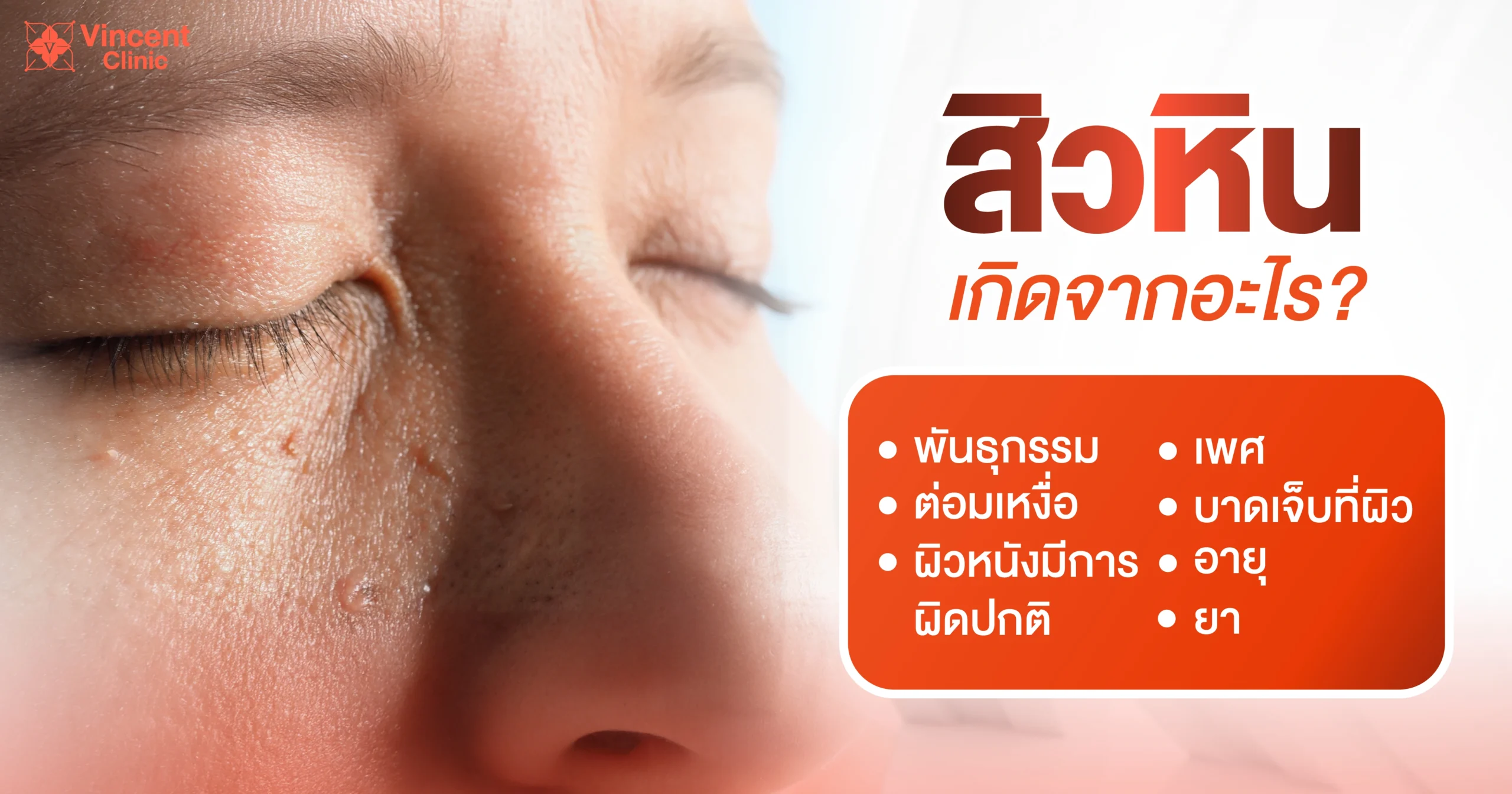 สิวหินเกิดจากอะไร