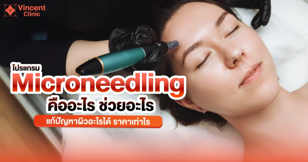 Microneedling