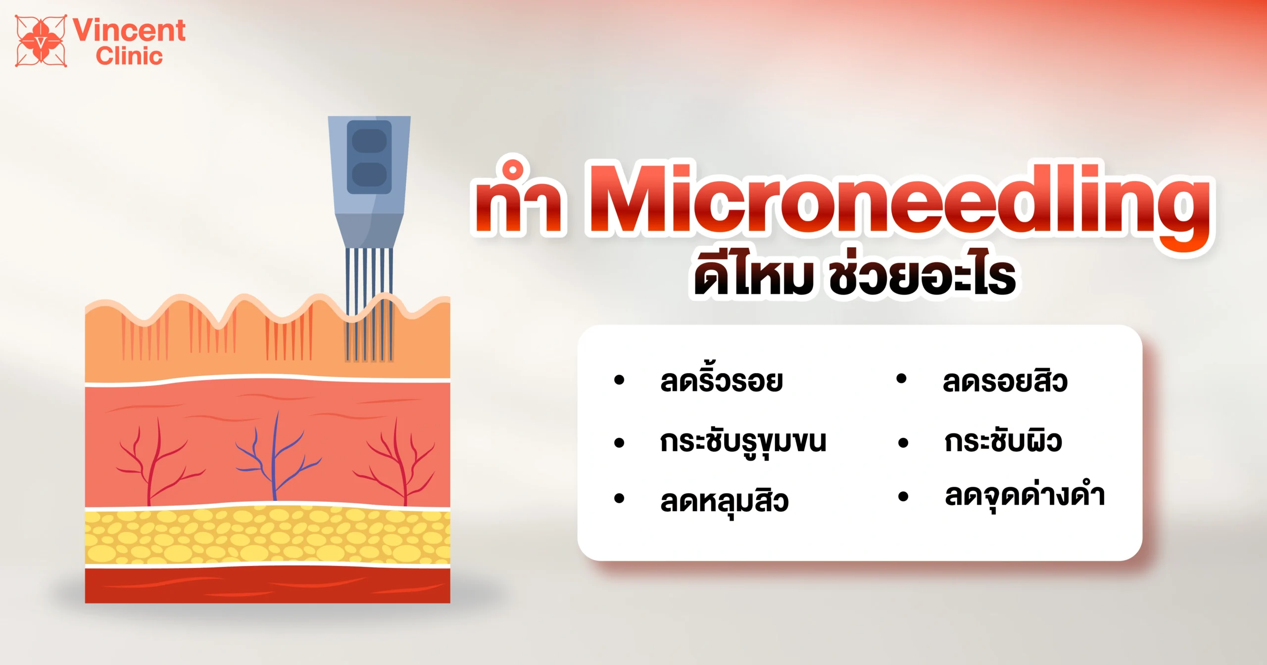Microneedling ช่วยอะไร