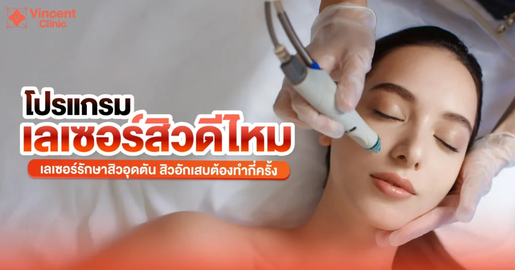 เลเซอร์สิวดีไหม