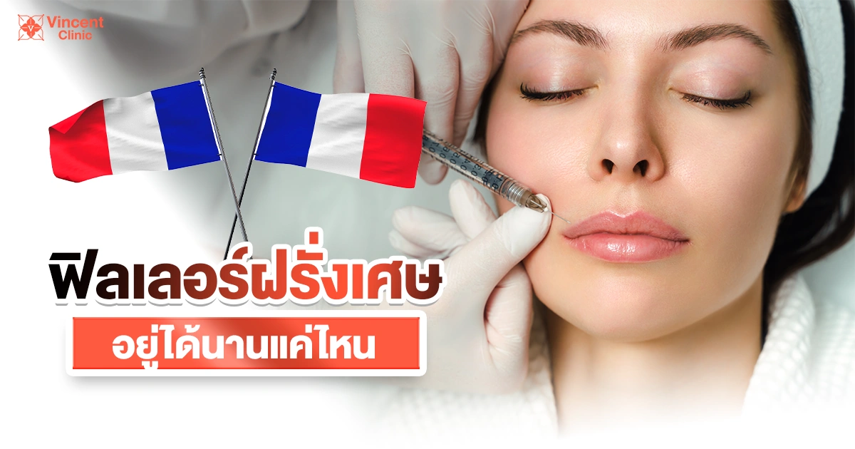 ฟิลเลอร์ฝรั่งเศสอยู่ได้นานแค่ไหน