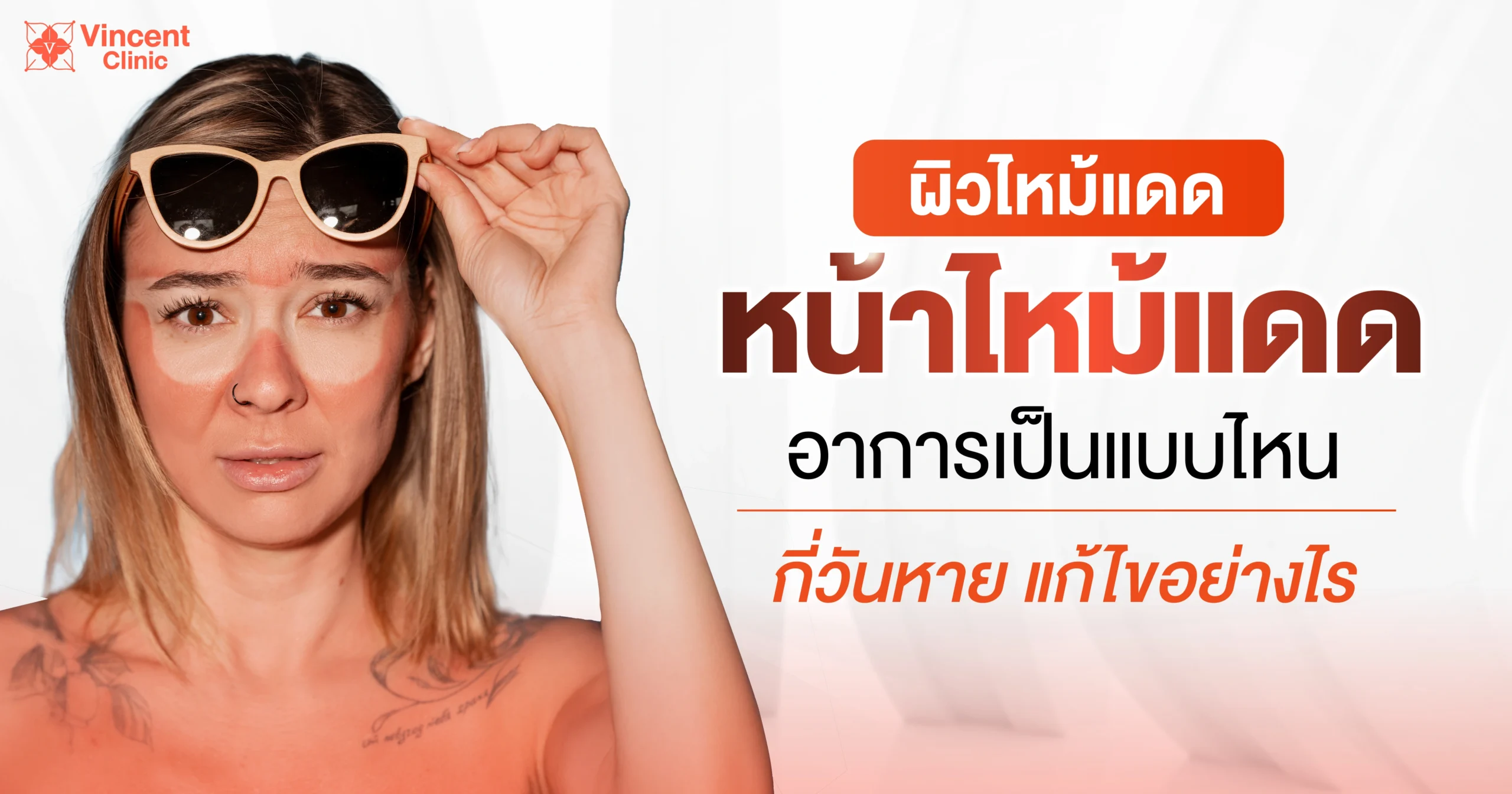 ผิวไหม้แดดอาการเป็นแบบไหน