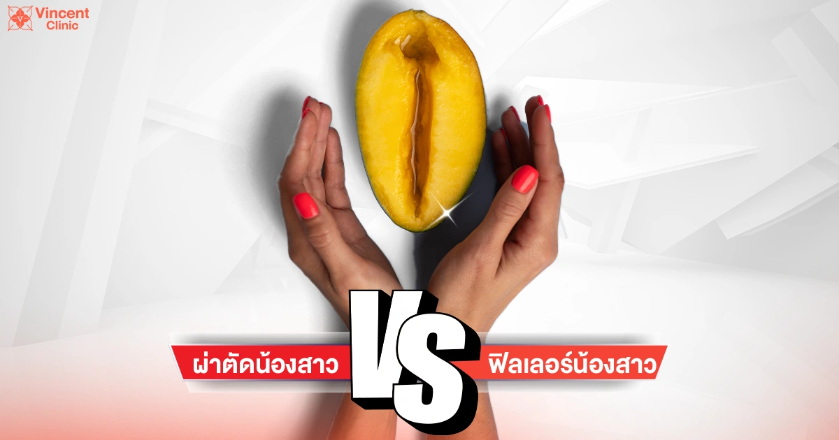 ผ่าตัดน้องสาว vs ฟิลเลอร์น้องสาว