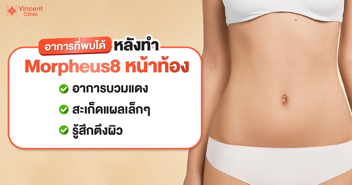 Possible reactions following Morpheus8 abdominal treatment อาการที่พบได้หลังทำ Morpheus8 หน้าท้อง