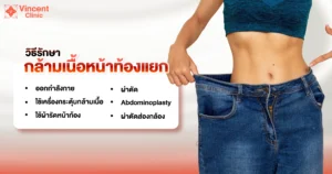 AW กล้ามเนื้อหน้าท้องแยก-01