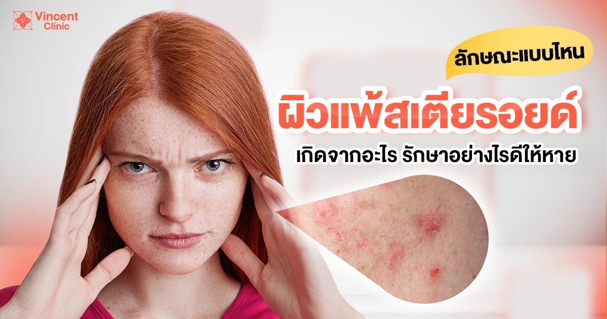 steroid-allergy-skin