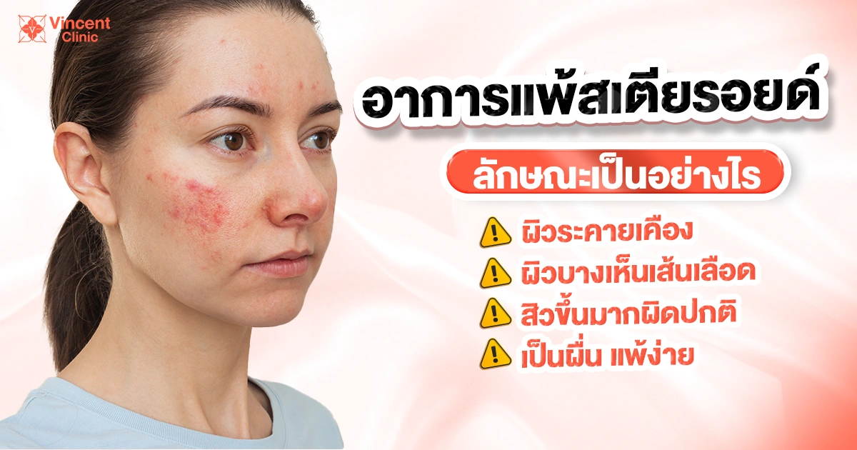 อาการแพ้สเตียรอยด์ลักษณะเป็นอย่างไร