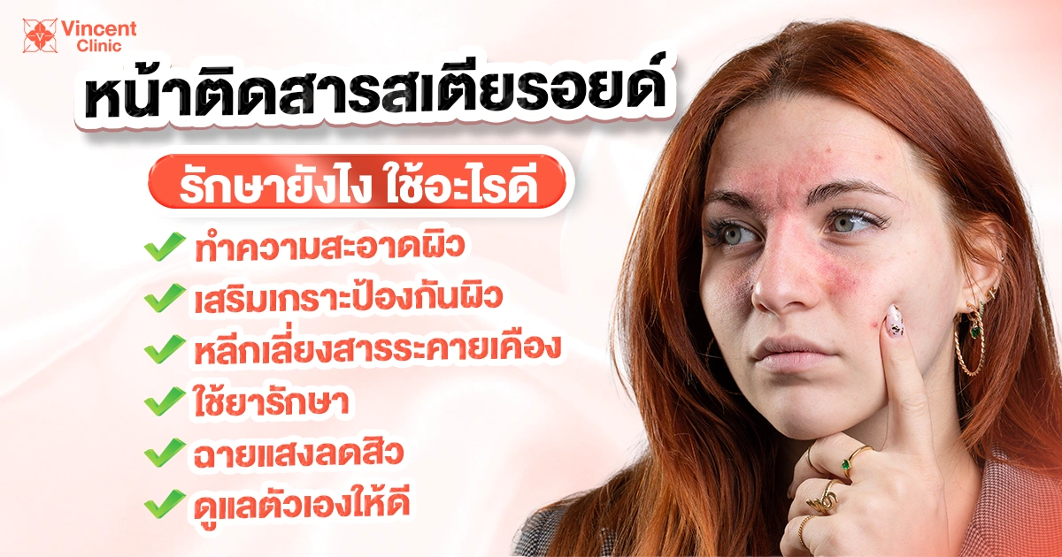 หน้าติดสารสเตียรอยด์รักษายังไง