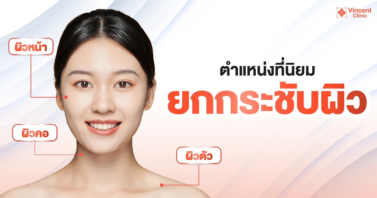 ตำแหน่งที่นิยมยกกระชับผิว