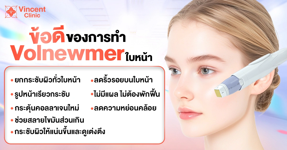 Advantages of making volnewmer