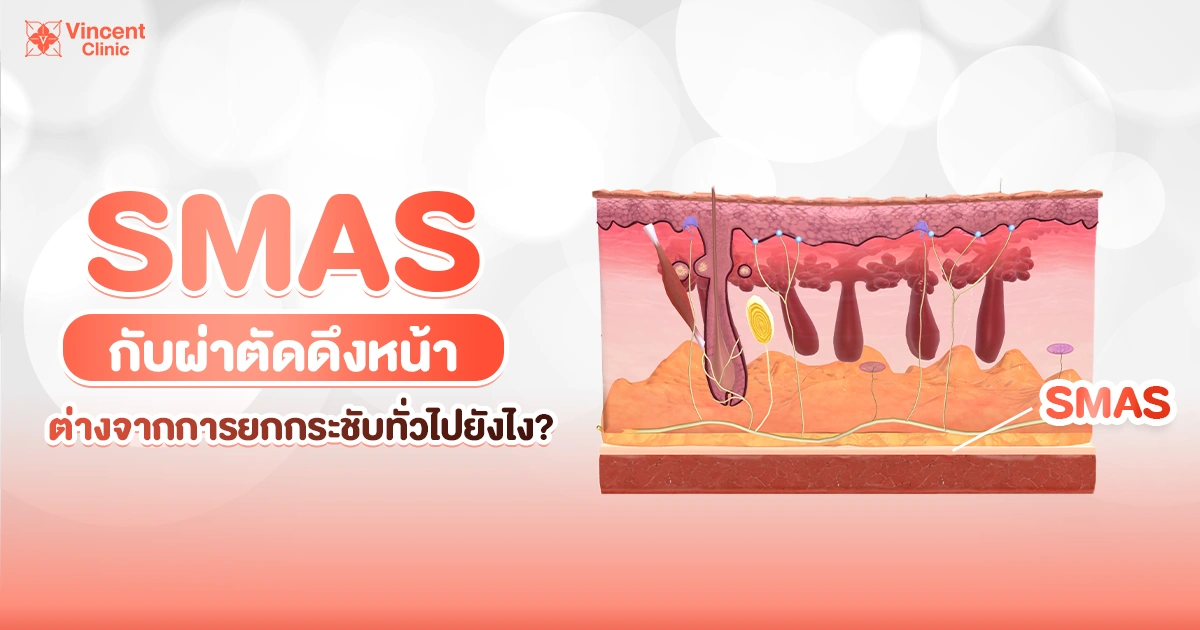 SMAS กับผ่าตัดดึงหน้าต่างจากยกกระชับทั่วไปอย่างไร