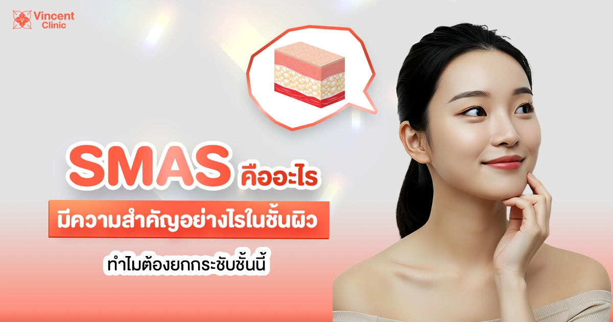 SMAS คืออะไร