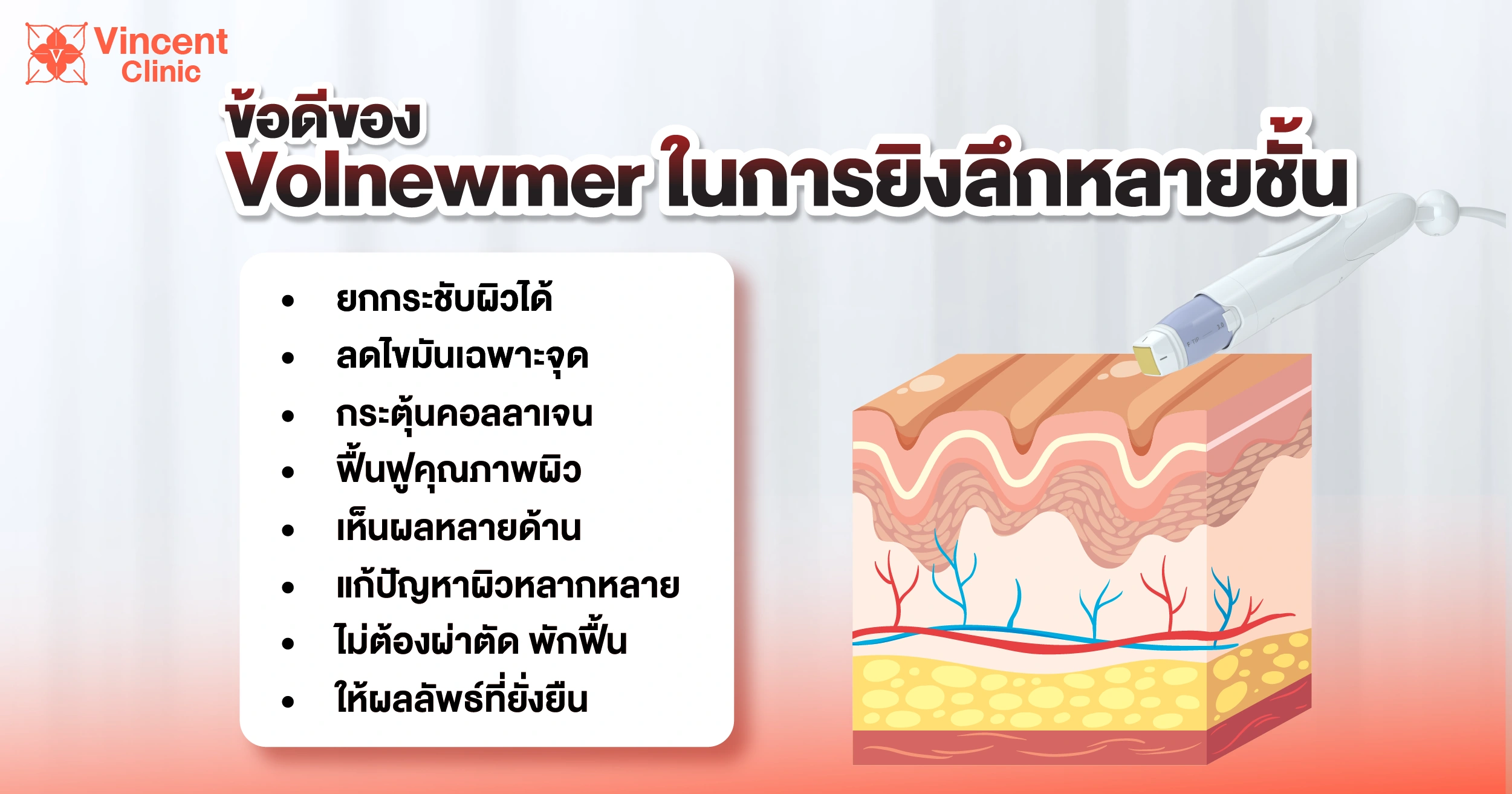 ข้อดีของ Volnewmer ที่ยิงลงได้หลายชั้น