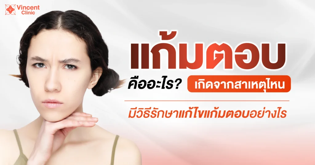 แก้มตอบคืออะไร เกิดจากสาเหตุไหน