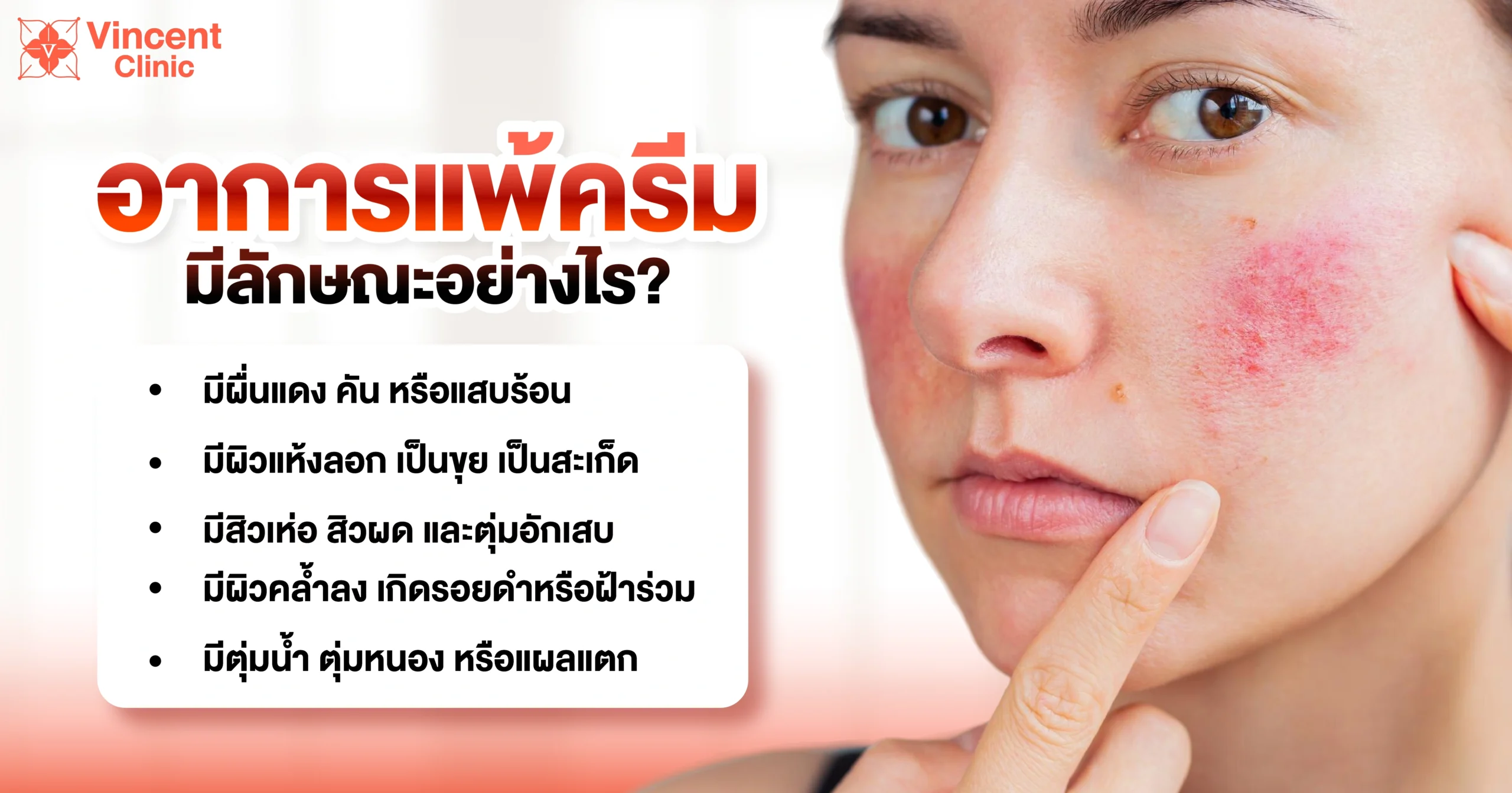 อาการแพ้ครีมเป็นแบบไหน