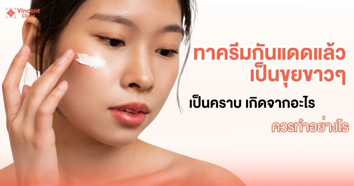 ทากันแดดแล้วเป็นคราบเกิดจาก