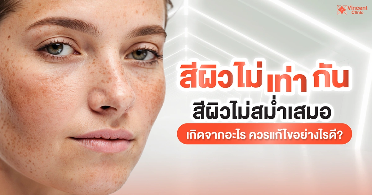 สีผิวไม่เท่ากันเกิดจากอะไร