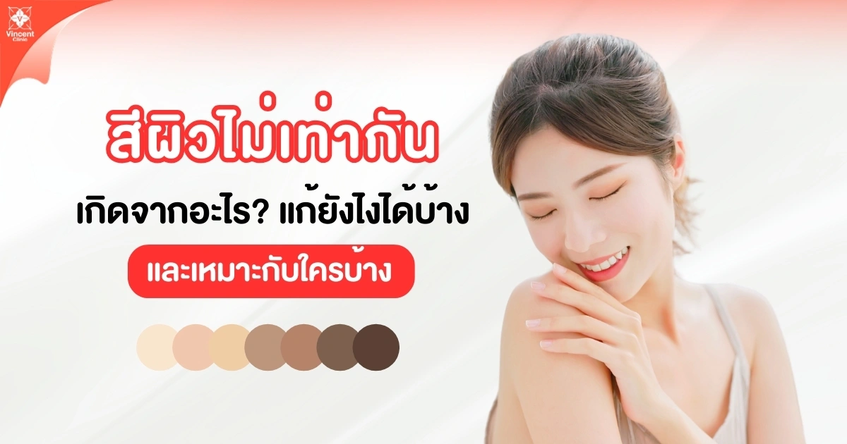 สีผิวไม่เท่ากันเกิดจากอะไร แก้ยังไง