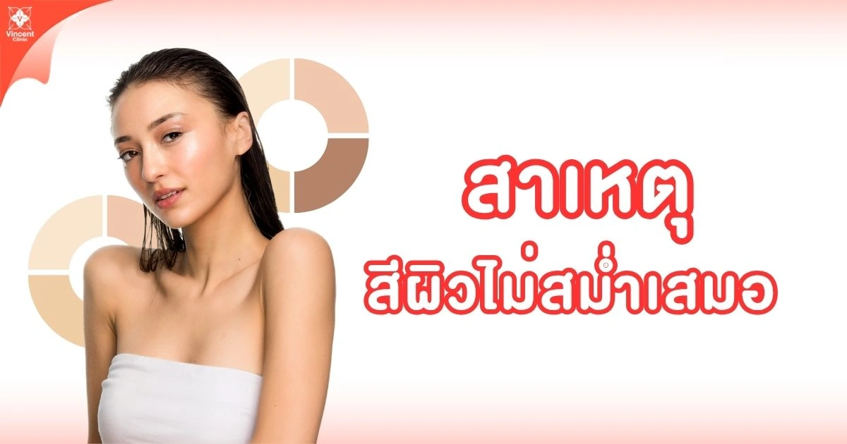 สีผิวไม่สม่ำเสมอเกิดจากอะไร