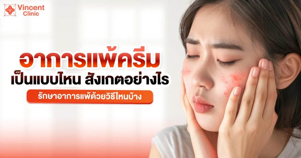 อาการแพ้ครีมเป็นแบบไหน