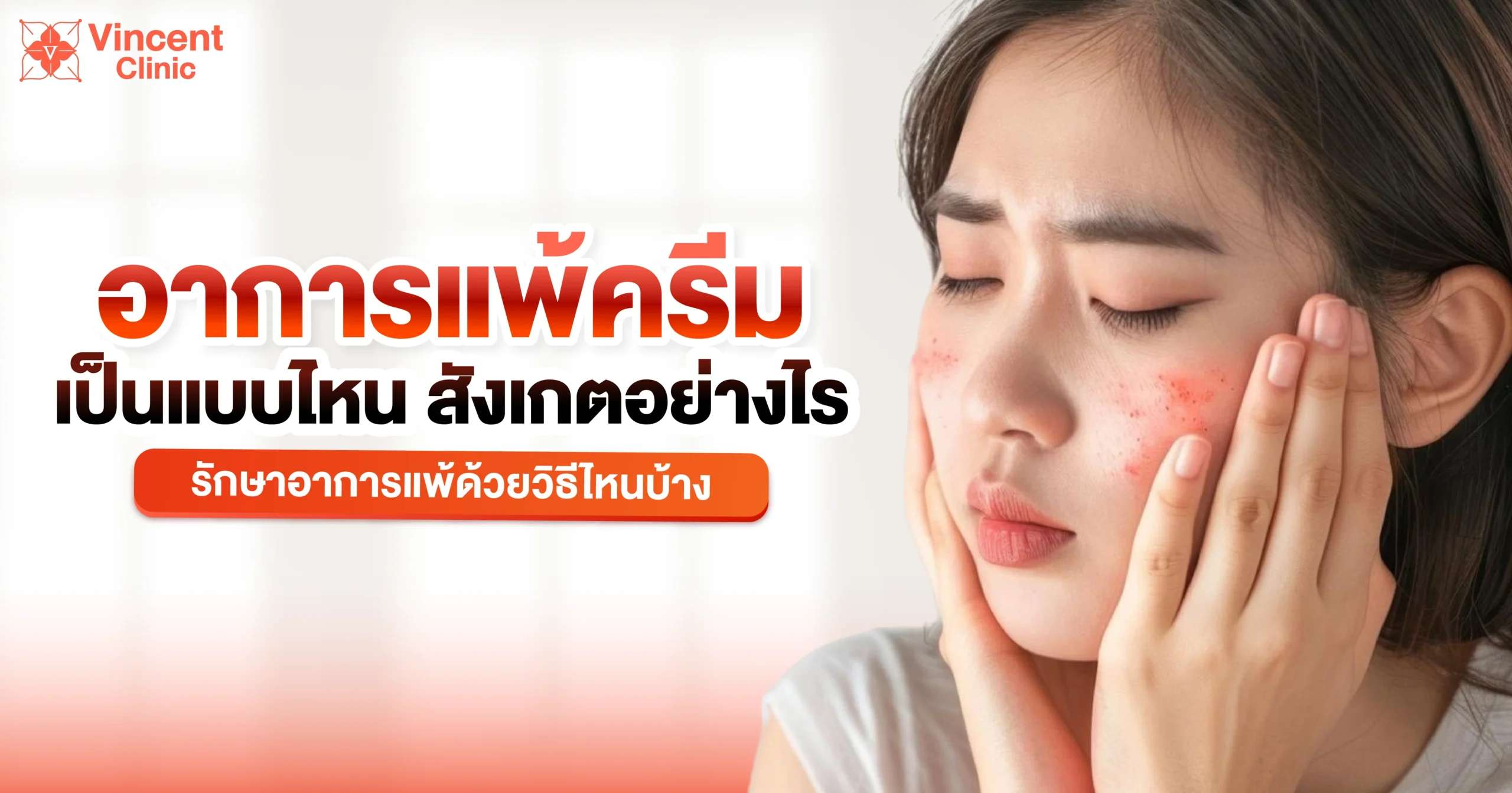 อาการแพ้ครีมเป็นแบบไหน