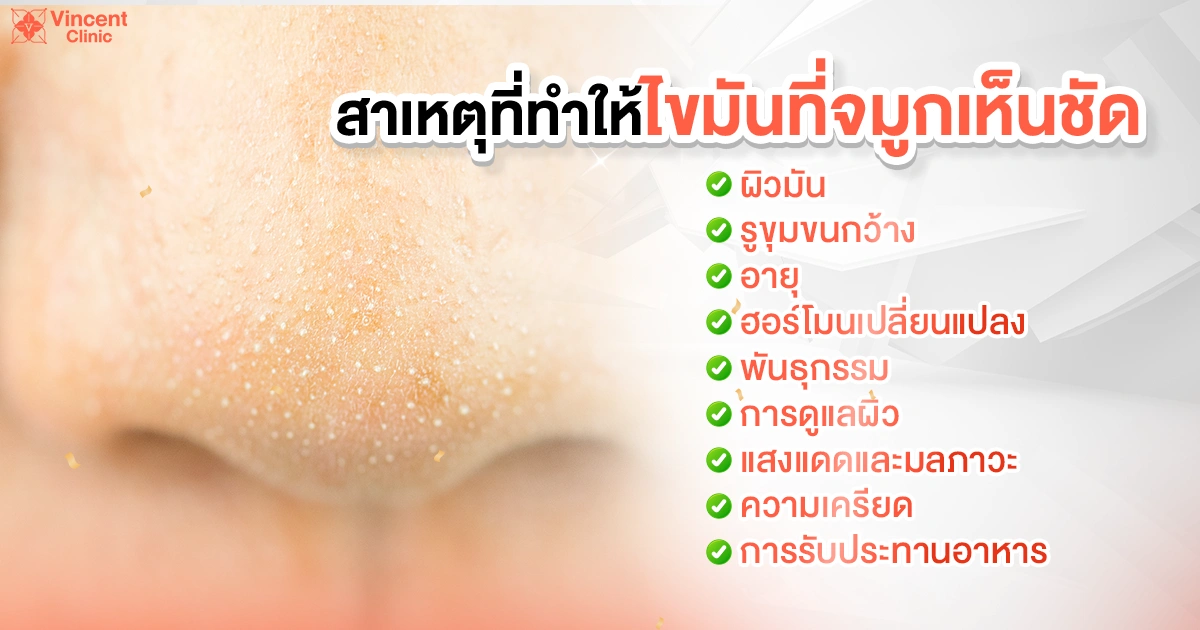 ไขมันจมูกเกิดจากอะไร